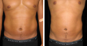 Before & After Photos